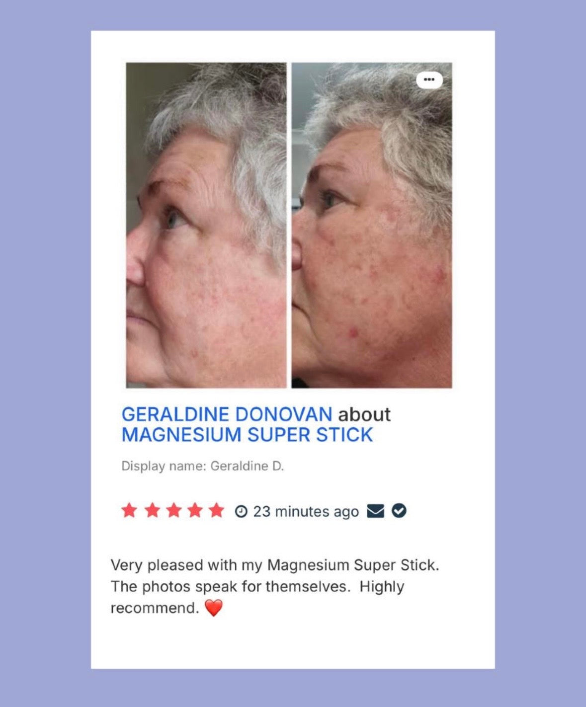 
                  
                    The Viral Magnesium Super Stick™ — For Skin Tags, Moles, Keratosis & Blemishes
                  
                
