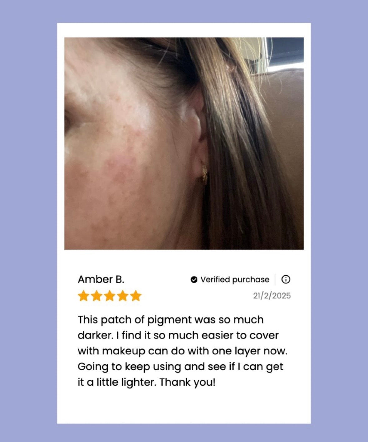 
                  
                    The Viral Magnesium Super Stick™ — For Skin Tags, Moles, Keratosis & Blemishes
                  
                