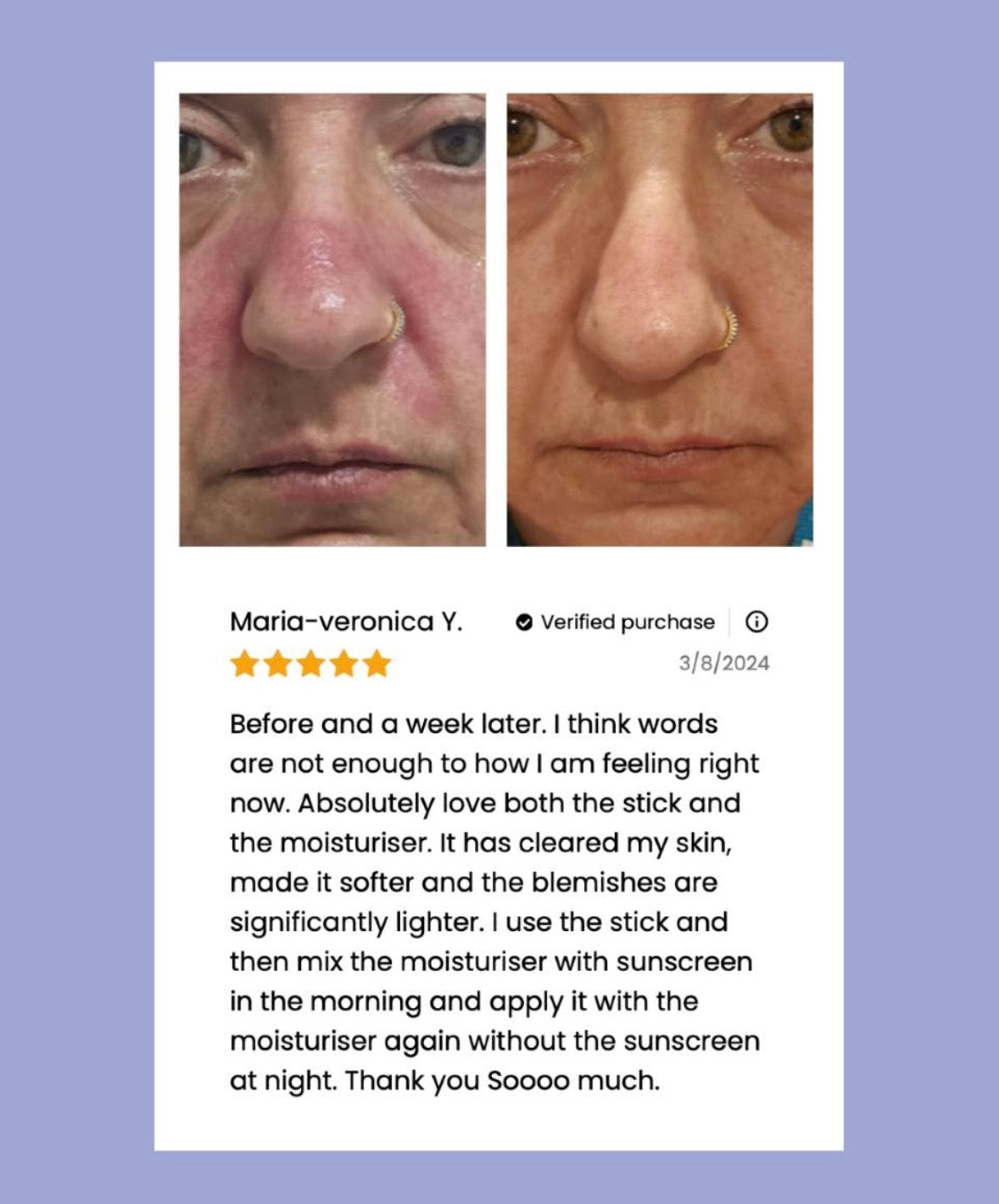 
                  
                    The Viral Magnesium Super Stick™ — For Skin Tags, Moles, Keratosis & Blemishes
                  
                
